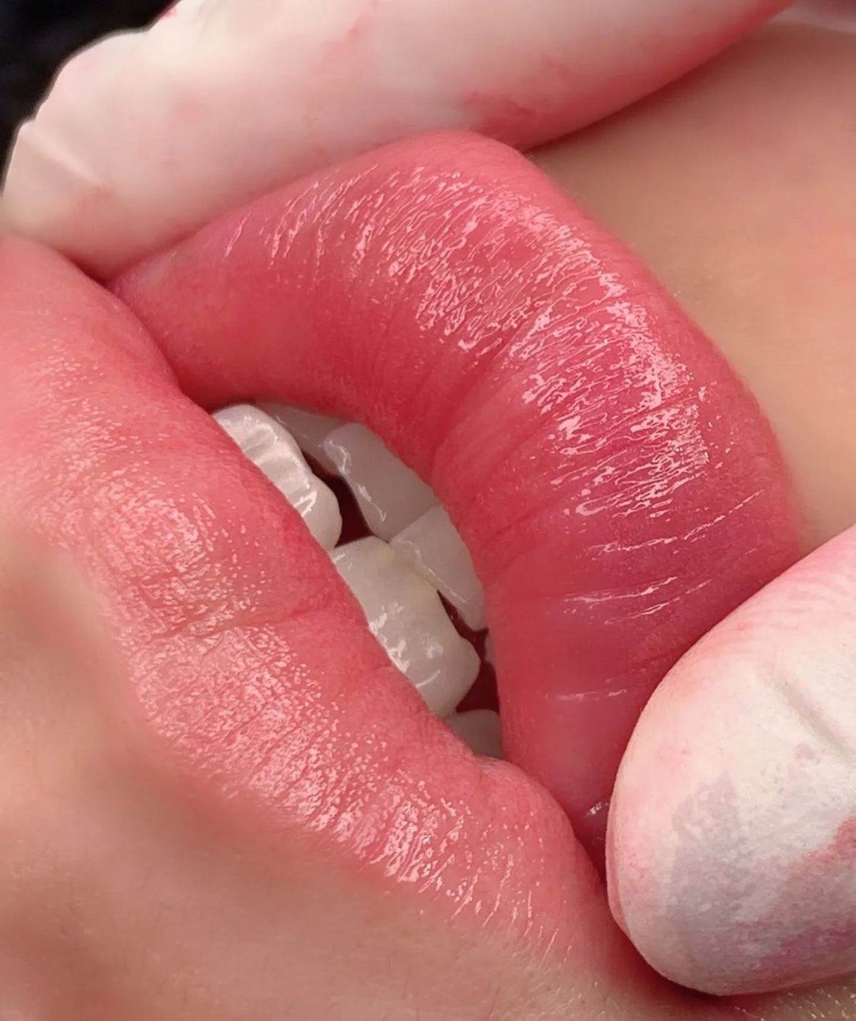 Phun môi nano là gì? Ưu nhược điểm và ai nên lựa chọn