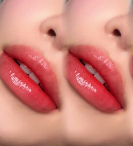 Phun môi pha lê là gì? Ưu nhược điểm & ai nên thực hiện