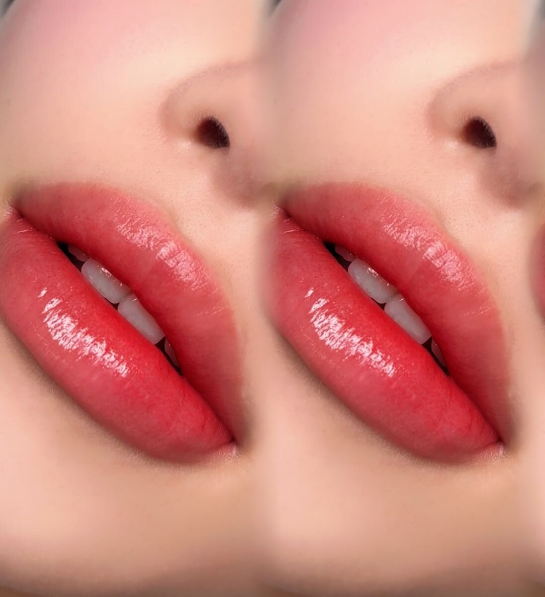 Phun môi pha lê là gì? Ưu nhược điểm & ai nên thực hiện