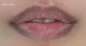 Phun môi phục hồi nền môi thâm: Công nghệ hay chỉ là chiêu marketing?