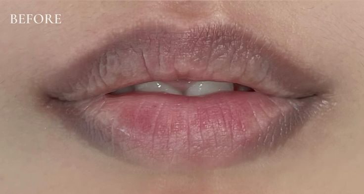 Phun môi phục hồi nền môi thâm: Công nghệ hay chỉ là chiêu marketing? 1 Phun môi phục hồi nền môi thâm: Công nghệ hay chỉ là chiêu marketing?