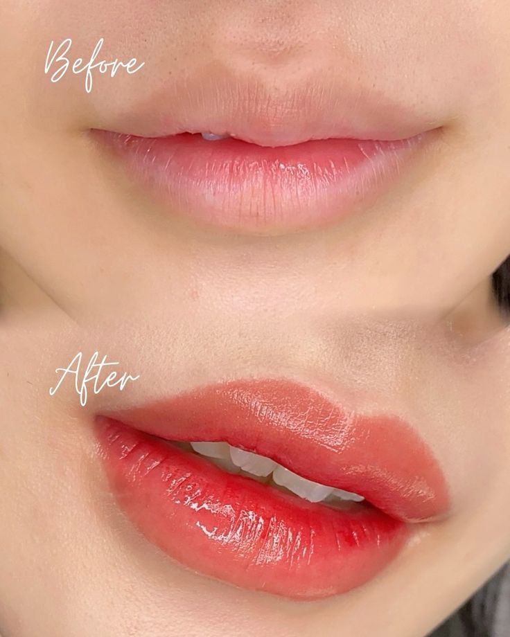 Phun môi sau 1 tháng vẫn thâm môi: Khi nào cần dặm lại?