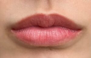 Phun môi tan viền là gì? Có nguy hiểm và khắc phục được không