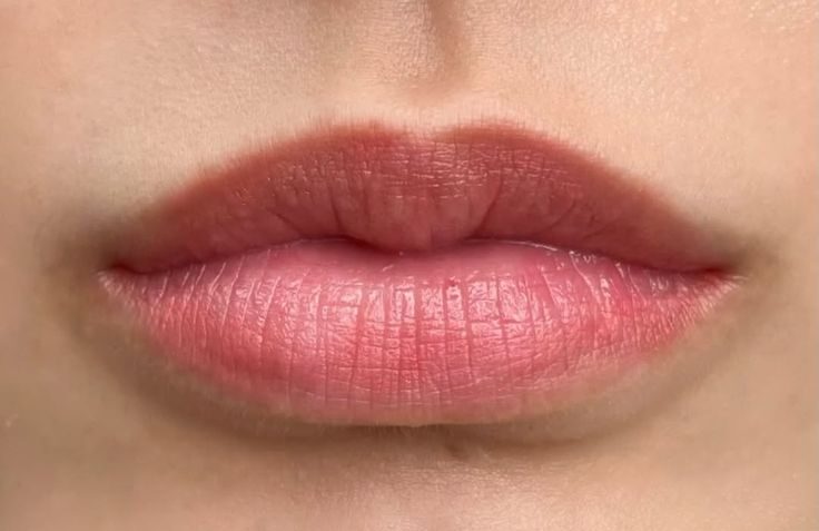 Phun môi tan viền là gì? Có nguy hiểm và khắc phục được không