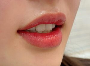 Phun môi tự nhiên là gì? Bí quyết giữ màu trong trẻo như môi thật 1 Phun môi tự nhiên là gì? Bí quyết giữ màu trong trẻo như môi thật