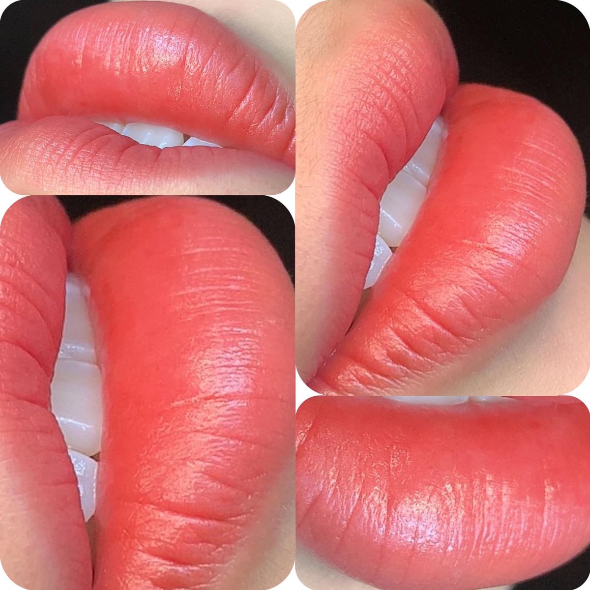 Phun môi xí muội, collagen hay nano – Chọn công nghệ nào là tốt nhất? 1 Phun môi xí muội, collagen hay nano – Chọn công nghệ nào là tốt nhất?