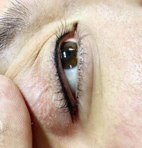 Phun xăm có đau không? Giải thích theo chuyên gia thẩm mỹ