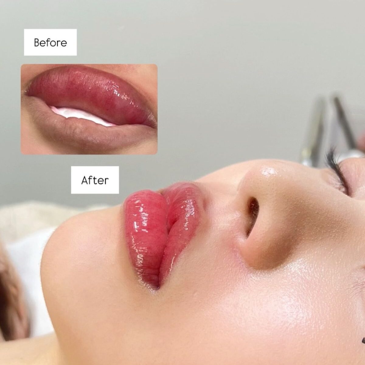 Phun xăm thẩm mỹ có an toàn không? Chuyên gia giải đáp