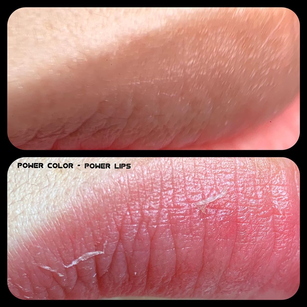 Từ phun xăm sang cấy màu sinh học: Ranh giới mới của ngành thẩm mỹ bán xâm lấn