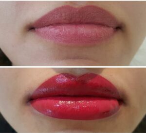 Vì sao phun môi bị ngứa sau 3 ngày? Nguyên nhân và cách xử lý an toàn