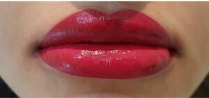 Vì sao phun môi bị ngứa sau 3 ngày? Nguyên nhân và cách xử lý an toàn