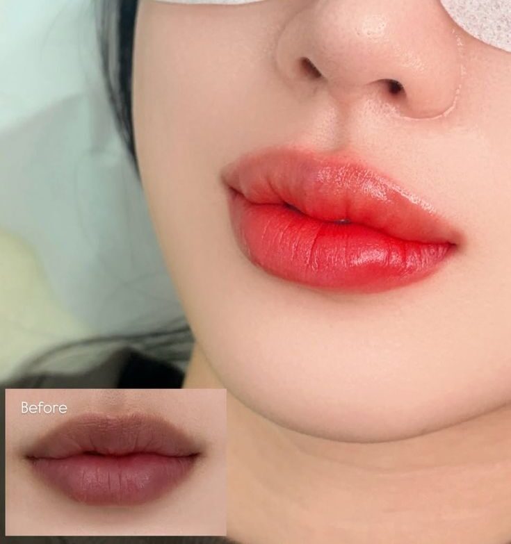 Phun môi collagen là gì? Bí quyết để có đôi môi căng mọng tự nhiên 4 Phun môi cho những ngày bận rộn nhưng vẫn muốn rạng rỡ