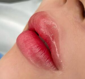 Phun môi có làm môi mỏng đi hoặc kém đàn hồi theo thời gian không? 3 Tự phun môi tại nhà – có thật sự an toàn?