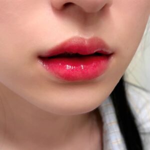 Phun môi có làm môi dày hơn không? Giải mã ngay