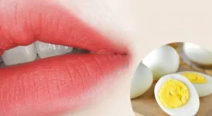 Phun môi có nên ăn trứng không? Lời giải đáp đúng khoa học