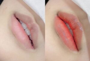 Phun môi có phù hợp với người lớn tuổi không?