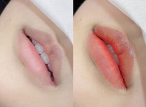 Phun môi là đầu tư cho nhan sắc hay chỉ là trào lưu nhất thời? 3 Phun môi lần đầu: những cảm giác không ai tả kỹ cho bạn