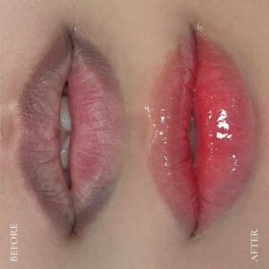 Phun môi – Định nghĩa lại vẻ đẹp của đôi môi mộc