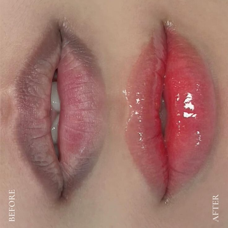 Phun môi – Định nghĩa lại vẻ đẹp của đôi môi mộc