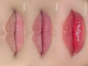 Phun môi có thật sự che được môi thâm lâu năm không, hay chỉ là hiệu ứng tạm thời? 2 Phun môi ngày Tết: nên hay không nên?