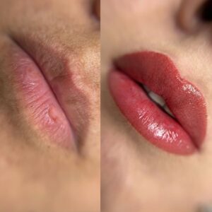 Đi phun môi lần đầu: Checklist không thể thiếu!