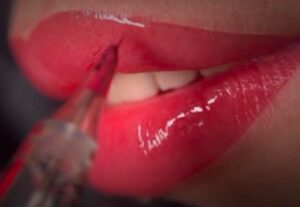 Phun môi có đau không — và cách giảm đau hiệu quả?