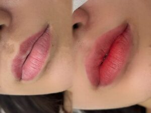 Phun môi không đều màu: nguyên nhân & cách sửa đúng cách