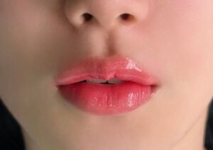 Phun môi – giải pháp cứu cánh cho môi thâm, môi nhợt màu bẩm sinh