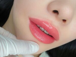 Phun môi có đau đến mức phải xin thôi không? Trải nghiệm thật 4 Phun môi lần đầu những điều chỉ người đã làm mới hiểu