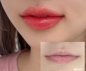 Phun môi: Một lần chăm, nhiều lần tự tin