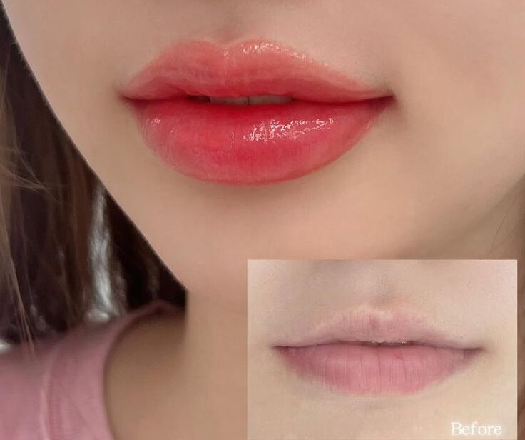 Các cấp độ thâm môi và cách xử lý trong phun xăm thẩm mỹ hiện nay 2 Phun môi: Một lần chăm, nhiều lần tự tin