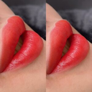 Phun môi xong bị thâm phải làm sao? Cách xử lý hiệu quả