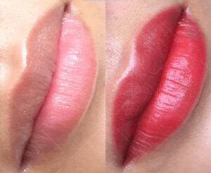 Phun môi là xu hướng hay là giải pháp làm đẹp lâu dài?