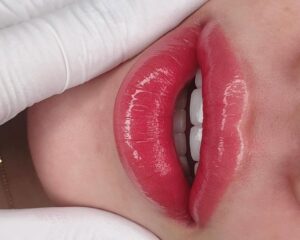 Phun môi và hành trình tìm lại sắc môi đã lãng quên