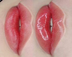 Môi thâm có phun môi được không và cần chuẩn bị gì?