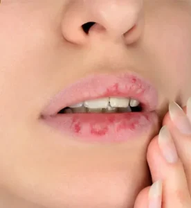 Những sai lầm phổ biến khiến phun môi không đạt hiệu quả mong muốn