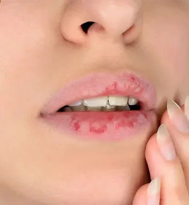 Bí quyết chăm sóc sau phun xăm môi giúp màu lên chuẩn & bền đẹp 3 Những sai lầm phổ biến khiến phun môi không đạt hiệu quả mong muốn