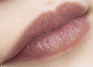 môi bị thâm sau phun