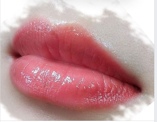 Ăn gì sau phun môi để hạn chế sưng, khô và xỉn màu?