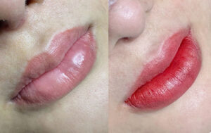 Phun môi có thật sự thay đổi thần thái khuôn mặt không? 3 chăm sóc môi sau phun