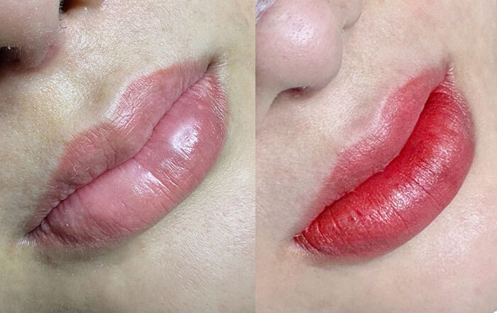 chăm sóc môi sau phun