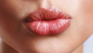 Phun môi bị hỏng có cải thiện được không? Giải pháp từ chuyên gia