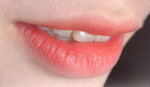 Những sai lầm phổ biến khiến phun môi không đạt màu mong muốn