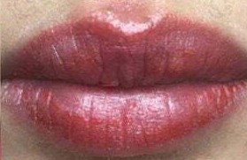 Những dấu hiệu cho thấy phun môi không đạt kết quả như mong muốn
