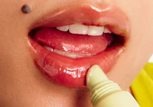 Phun môi xong nên bôi gì để môi bong tự nhiên, không đau rát?