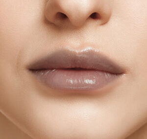 Môi bị thâm sau phun: nguyên nhân do đâu và hướng khắc phục an toàn