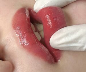 Phun môi xong bao lâu thì có thể ăn uống bình thường?