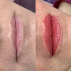 Phun môi collagen là gì? Có nên làm không? Review chi tiết 2026