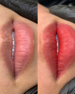 Phun môi lần đầu nên chọn màu theo da hay theo độ thâm môi?