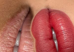 Cách phục hồi môi thâm sau Tết bằng công nghệ phun môi Nano